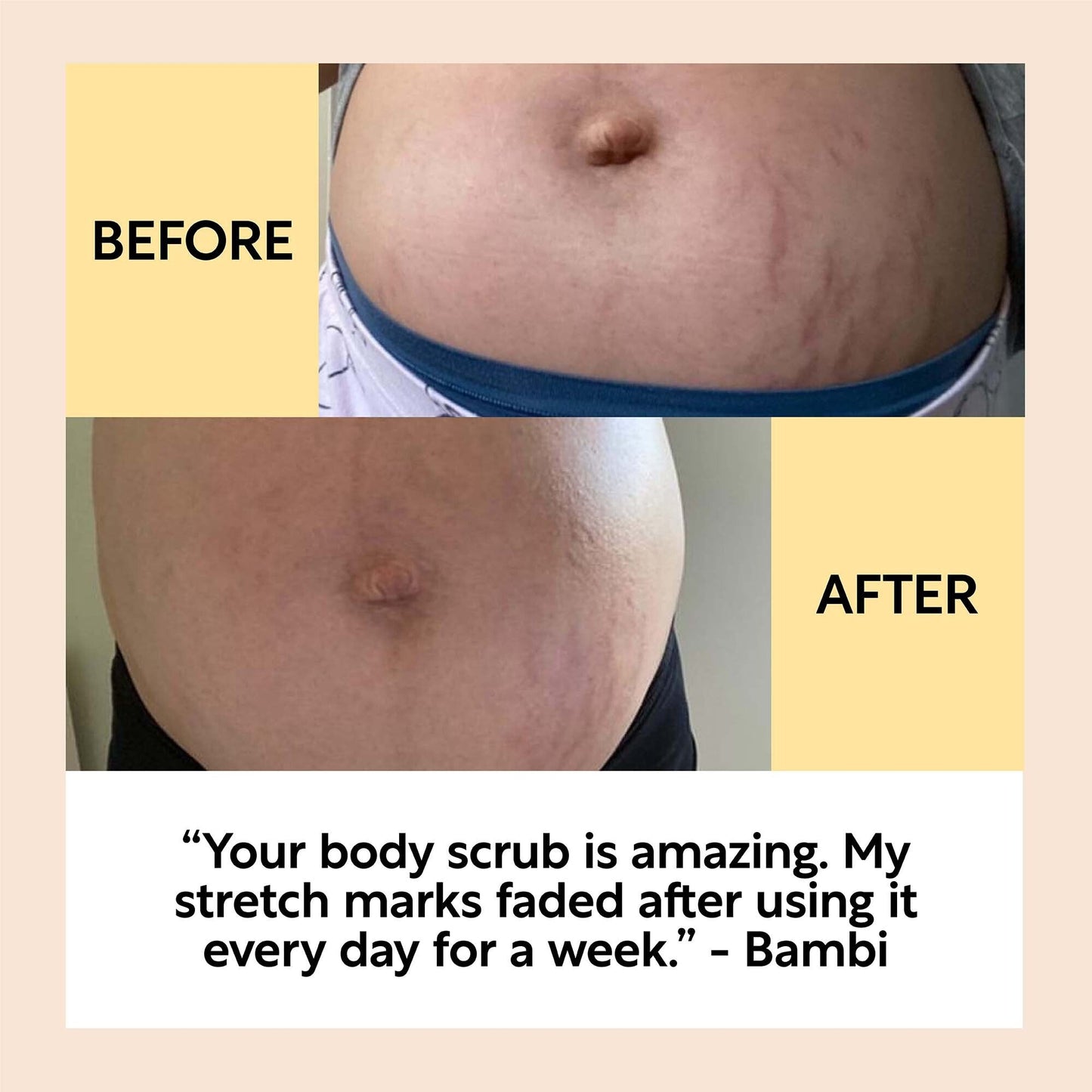Bodycare Bundle